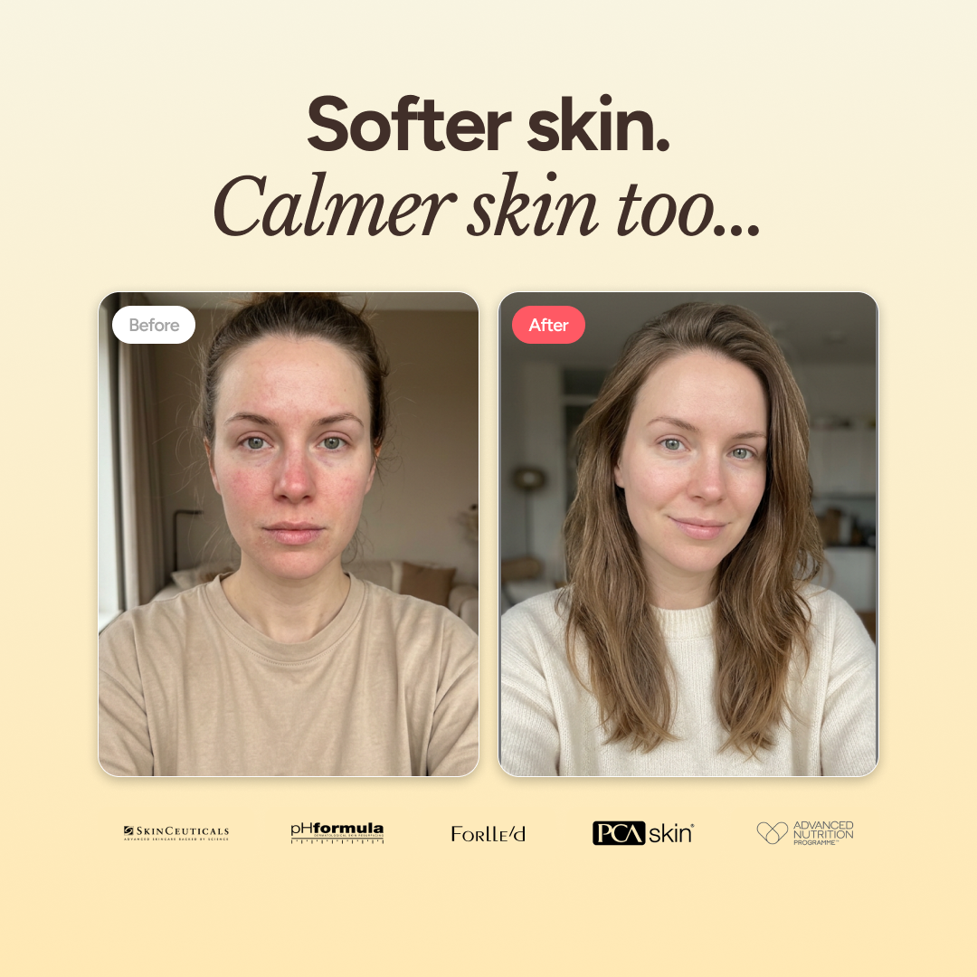 Gentle Cleanser