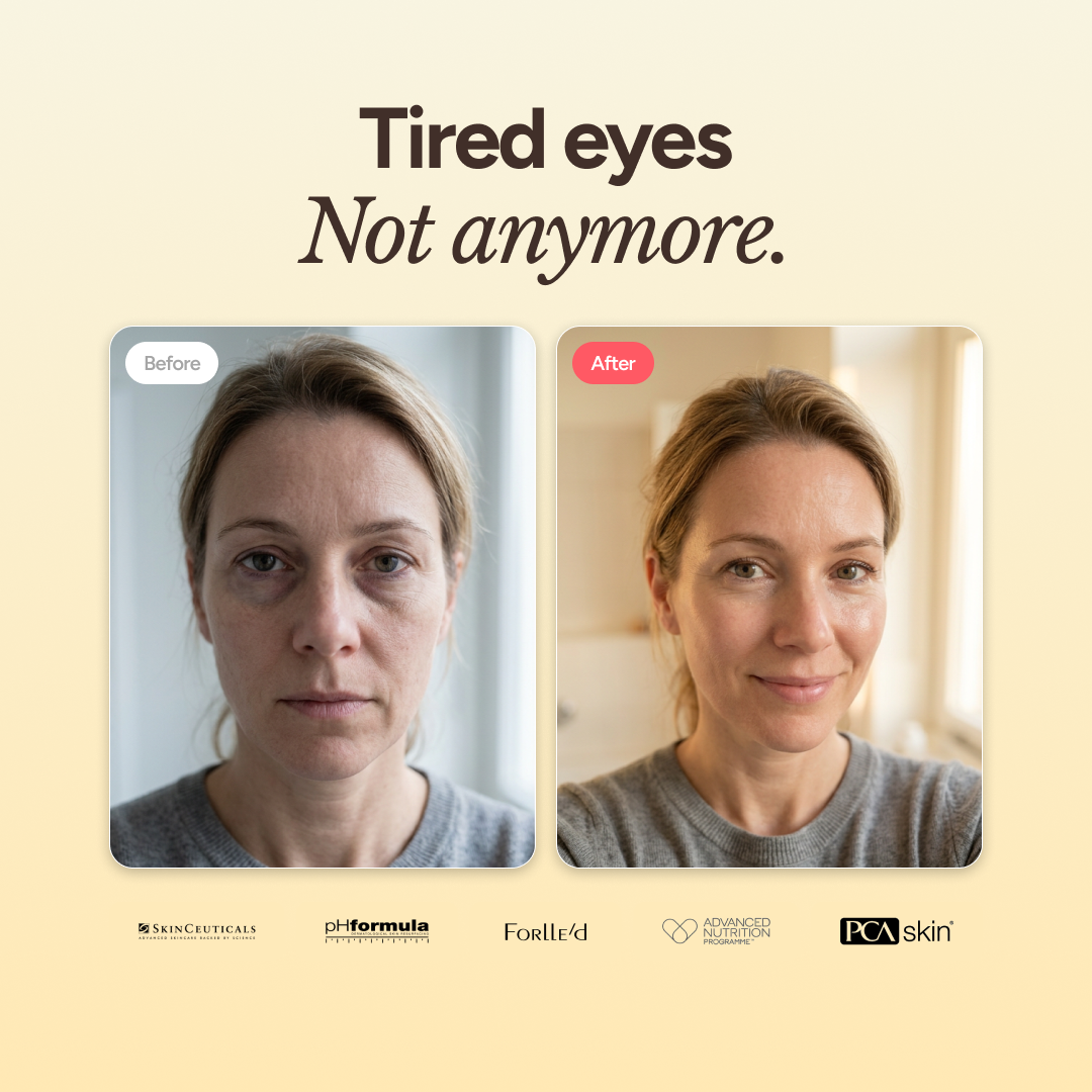 A.G.E. Eye Complex