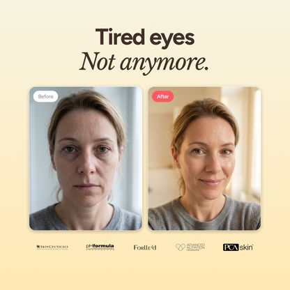 A.G.E. Eye Complex