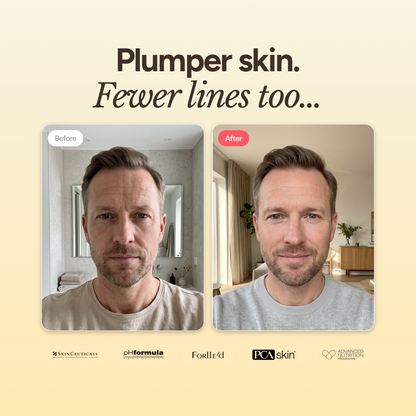 AGE Recovery