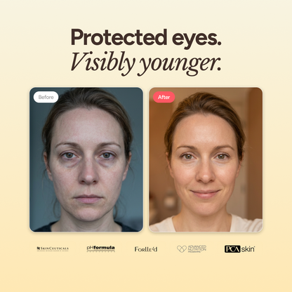 AOX+ Eye Gel
