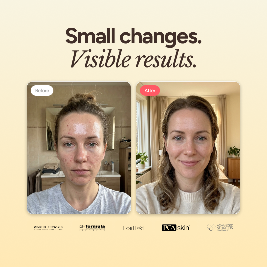 Blemish + Age Defense