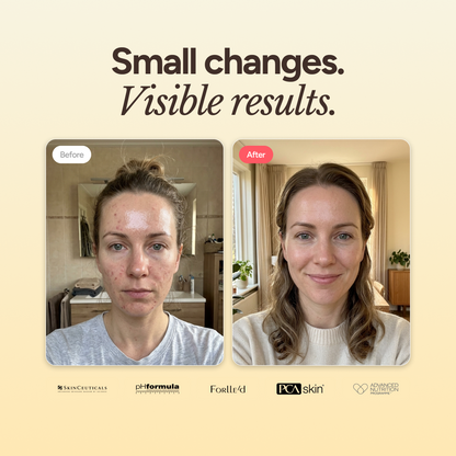 Blemish + Age Defense