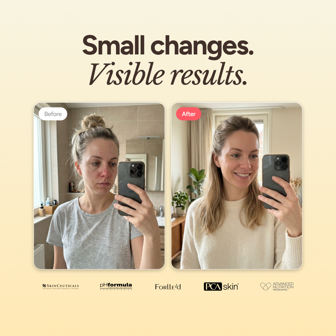 Blemish + Age Cleanser