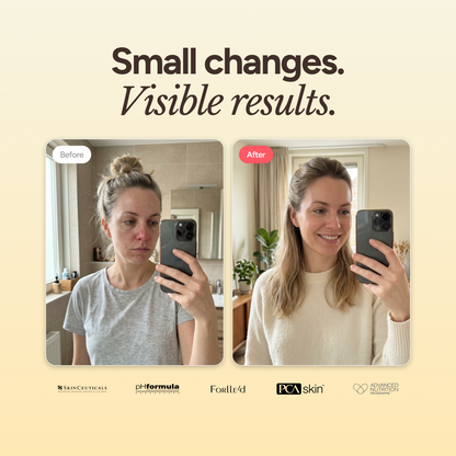 Blemish + Age Cleanser
