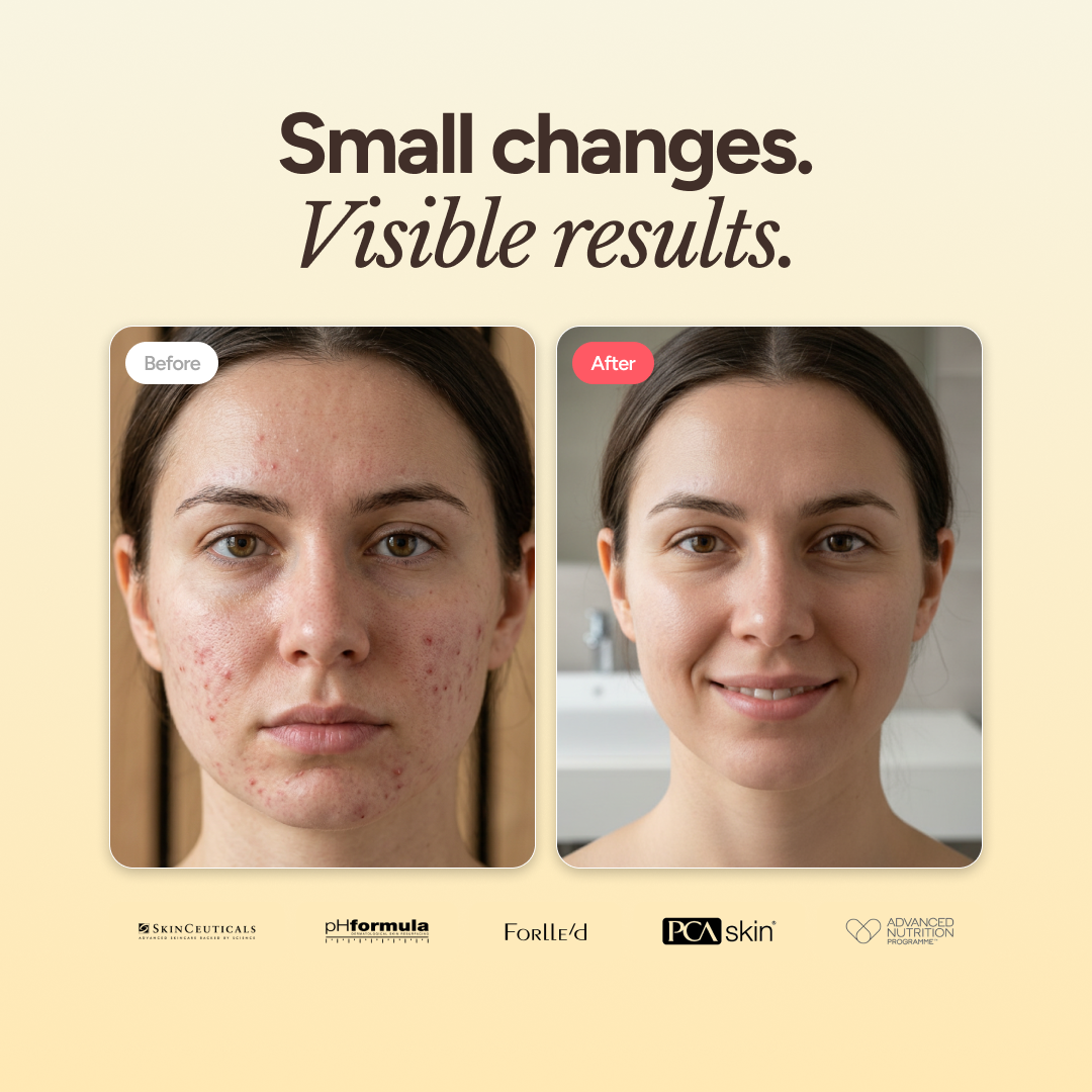pHformula UV Protect SPF 30+