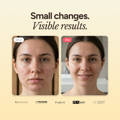 pHformula UV Protect SPF 30+