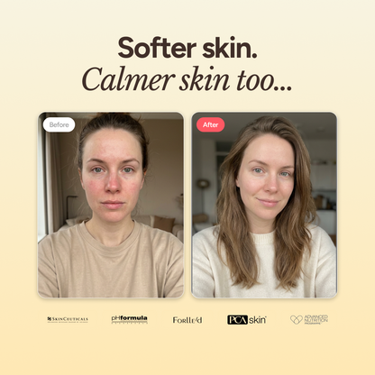 Gentle Cleanser