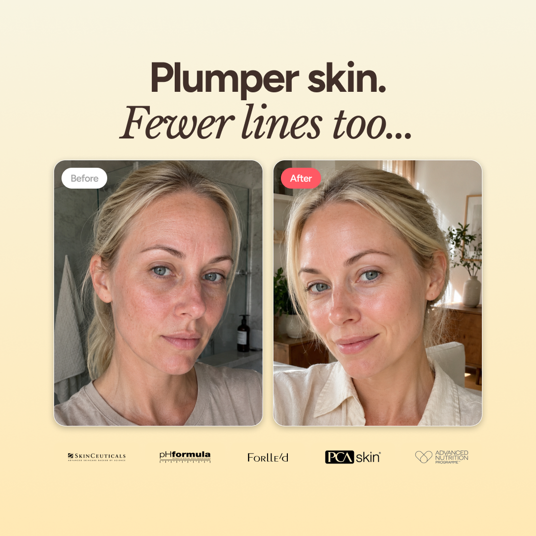 pHformula MESO X Boost | Advanced Skin Regeneration Booster