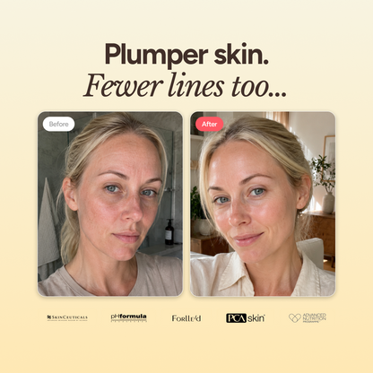 pHformula MESO X Boost | Advanced Skin Regeneration Booster